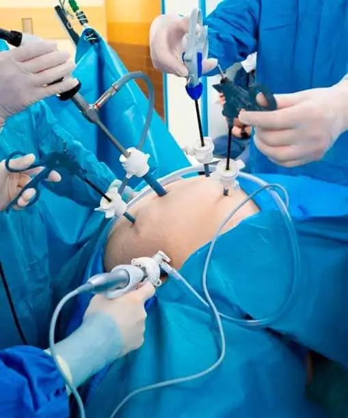 Quirófano con pinzas de laparoscopía